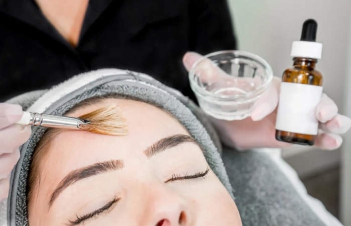 A Brief History of Chemical Peels