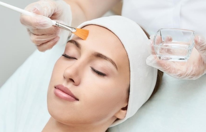 What is a Chemical Peel_