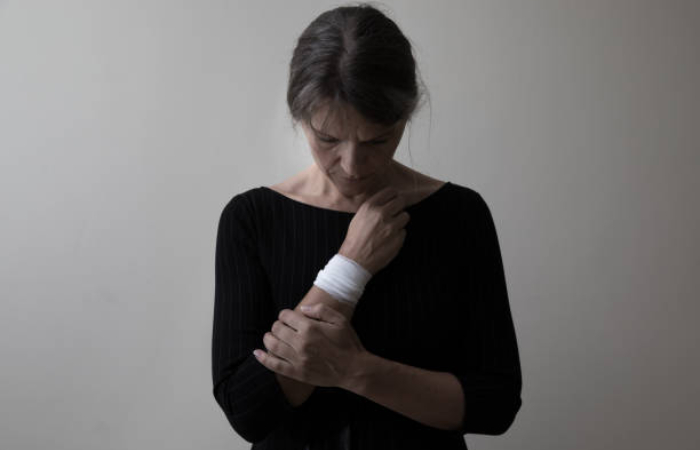 Treating Mature Self-Harm Scars