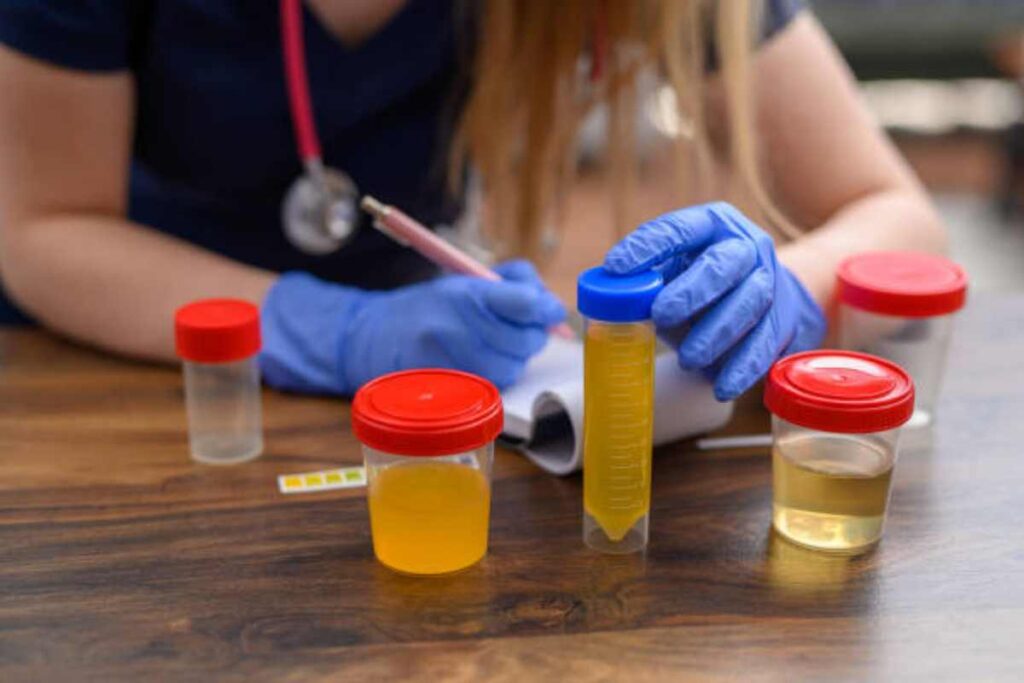 Calprotectin Stool Test