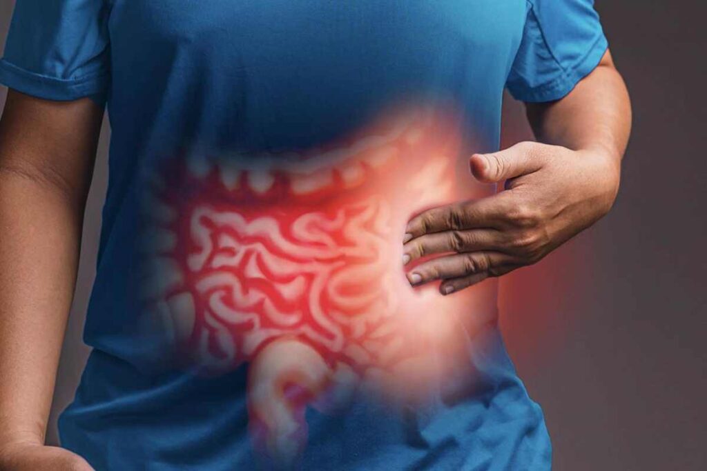 Inflammatory Bowel Disease