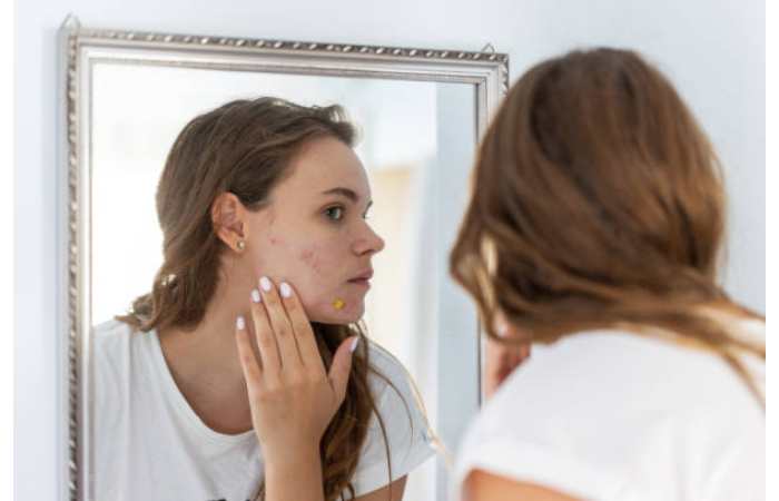 Skin Allergies Write for us