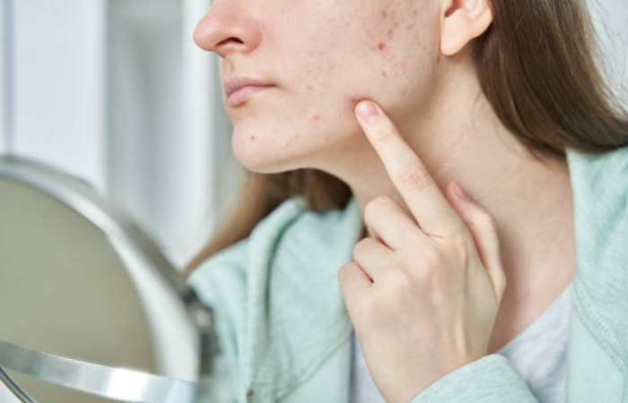 Skin Allergies